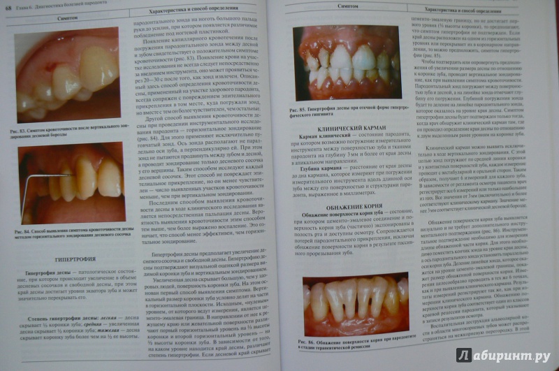 Иллюстрация 4 из 30 для Терапевтическая стоматология. Учебник в 3-х частях. Часть 2. Болезни пародонта - Барер, Лемецкая, Суражев | Лабиринт - книги. Источник: Марина