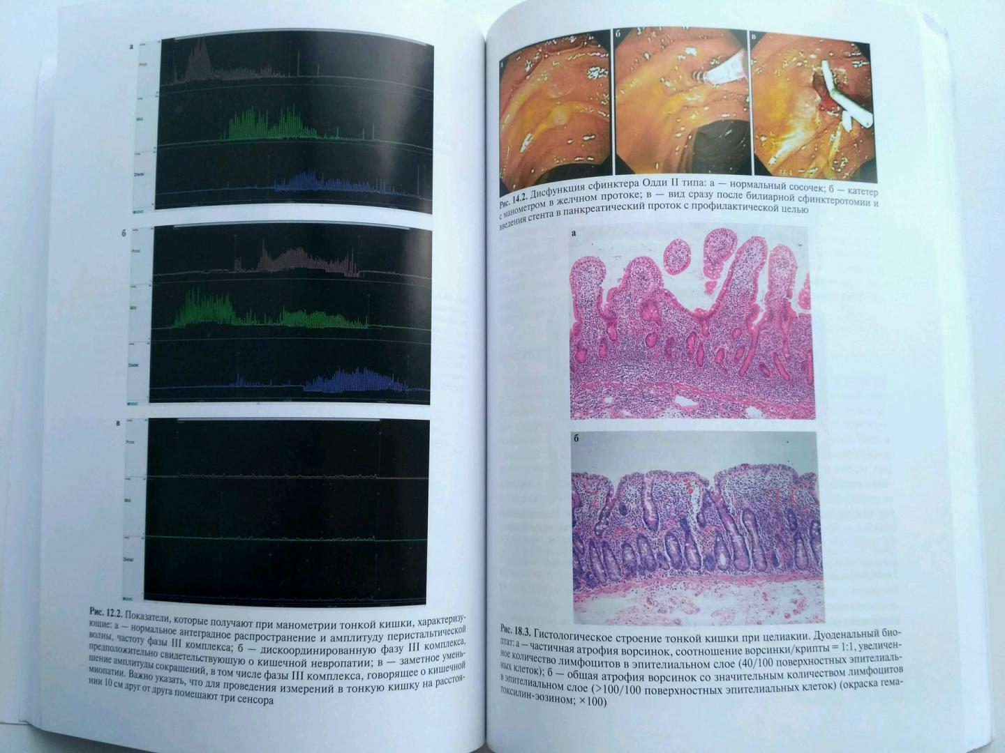 Иллюстрация 26 из 31 для Функциональные расстройства желудочно-кишечного тракта. Практический подход на основе клинического - Лэйси, Кроуэлл, ДиБайз | Лабиринт - книги. Источник: Sunnygirl