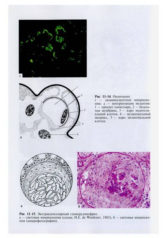Иллюстрация 7 из 8 для Нефрология (+CD) | Лабиринт - книги. Источник: Ялина