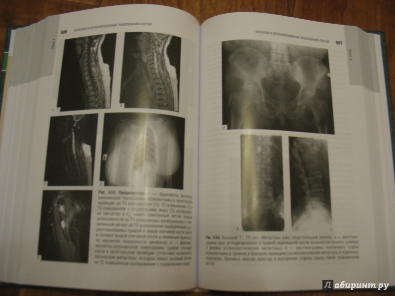 Иллюстрация 7 из 11 для Лучевая диагностика заболеваний костей и суставов. Национальное руководство | Лабиринт - книги. Источник: Крелена