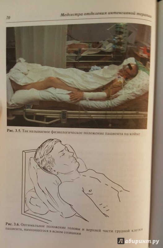 Иллюстрация 5 из 6 для Медсестра отделения интенсивной терапии - Кассиль, Хапий | Лабиринт - книги. Источник: Den