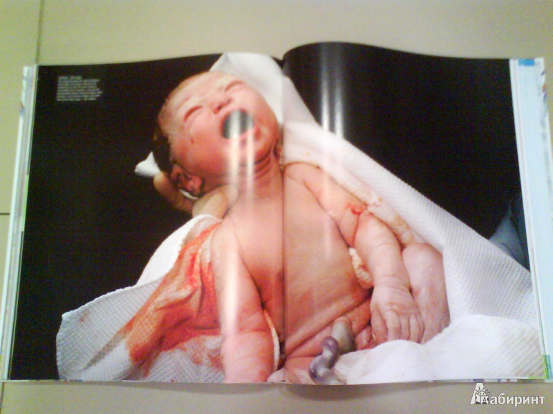 Иллюстрация 8 из 25 для Книга о беременности - Брюэр, Дэйвис, Бхаттачарья, Мередит, Престон | Лабиринт - книги. Источник: Мила