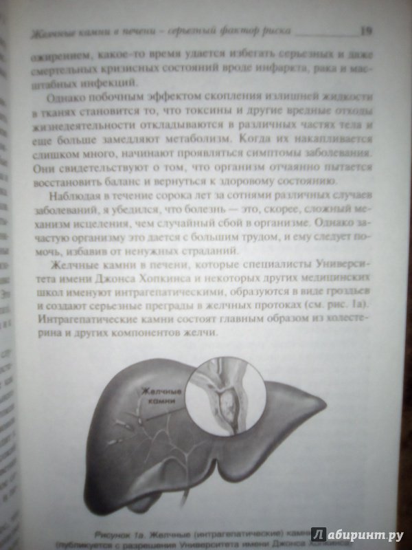Иллюстрация 8 из 24 для Удивительное очищение желчного пузыря и печени - Андреас Мориц | Лабиринт - книги. Источник: Лабиринт