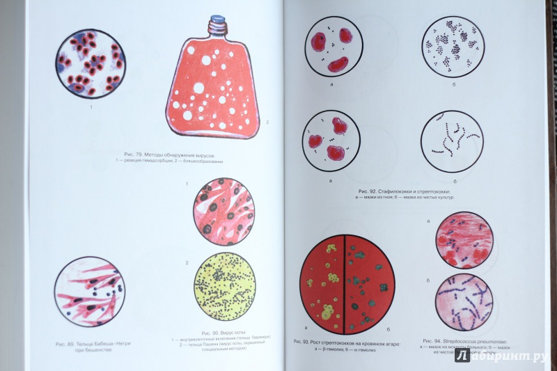 Иллюстрация 12 из 29 для Медицинская микробиология, иммунология и вирусология - Коротяев, Бабичев | Лабиринт - книги. Источник: x rabid bitch x