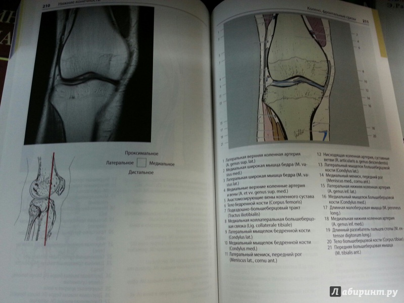 Иллюстрация 11 из 12 для Атлас секционной анатомии человека на примере КТ- и МРТ-срезов. Том 3. Позвоночник, конечности - Меллер, Райф | Лабиринт - книги. Источник: Den