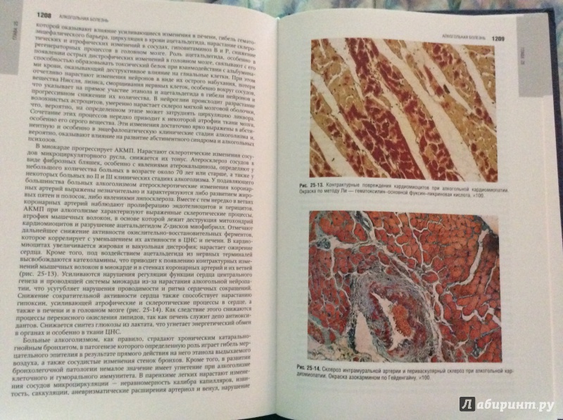Иллюстрация 16 из 16 для Патологическая анатомия. Национальное руководство (+CD) - Пальцев, Кактурский, Зайратьянц | Лабиринт - книги. Источник: Angelina-161rus