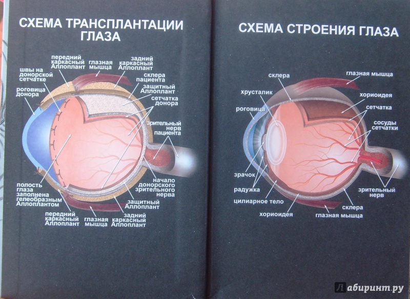 Донор глаза. Трансплантация глазного яблока. Трансплантология глаз. Аллоплант для сетчатки глаза. Трансплантация зрительного нерва.