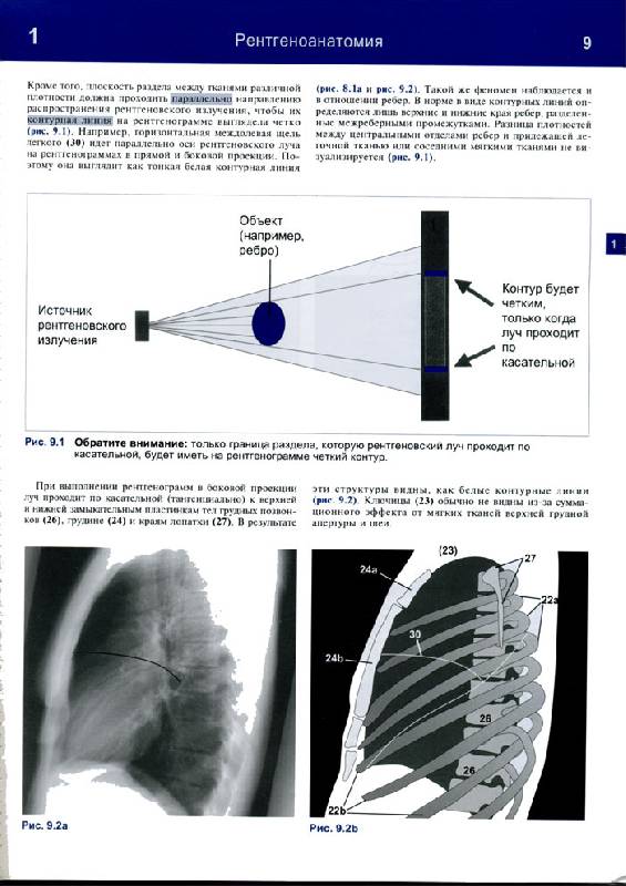 Иллюстрация 31 из 32 для Рентгенологическое исследование грудной клетки. Практическое руководство - Матиас Хофер | Лабиринт - книги. Источник: Кнопа2