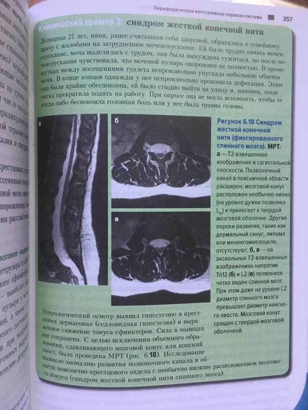Иллюстрация 20 из 27 для Топический диагноз в неврологии по Петеру Дуусу. Анатомия. Физиология. Клиника - Бер, Фротшер | Лабиринт - книги. Источник: Лабиринт