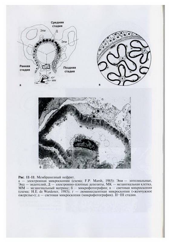 Иллюстрация 4 из 8 для Нефрология (+CD) | Лабиринт - книги. Источник: Ялина