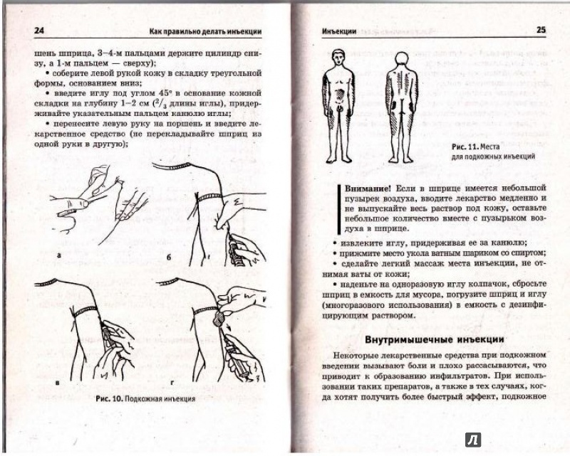 Иллюстрация 3 из 19 для Как правильно делать инъекции - Наталья Соколова | Лабиринт - книги. Источник: Natalya4099