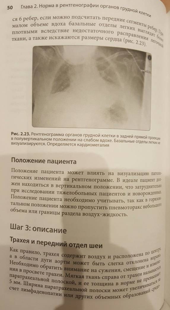 Иллюстрация 19 из 22 для Клиническая интерпретация рентгенограммы легких - Дарби, Эди, Чендрейтриа | Лабиринт - книги. Источник: Den