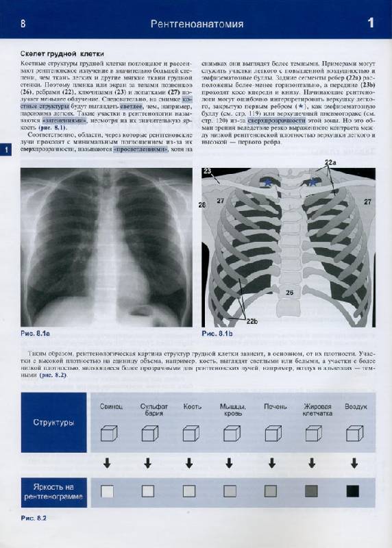 Иллюстрация 30 из 32 для Рентгенологическое исследование грудной клетки. Практическое руководство - Матиас Хофер | Лабиринт - книги. Источник: Кнопа2