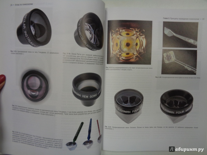 Иллюстрация 11 из 13 для Атлас по гониоскопии (+CD) - Олвэрд, Лонгмуа | Лабиринт - книги. Источник: Сокол-Ан