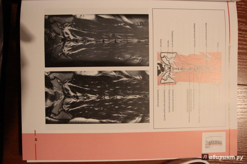 Иллюстрация 9 из 15 для МРТ костно-мышечной системы. Атлас - Роен, Лютьен-Дреколл, Хойк, Стайнборн | Лабиринт - книги. Источник: Книжные коллекции