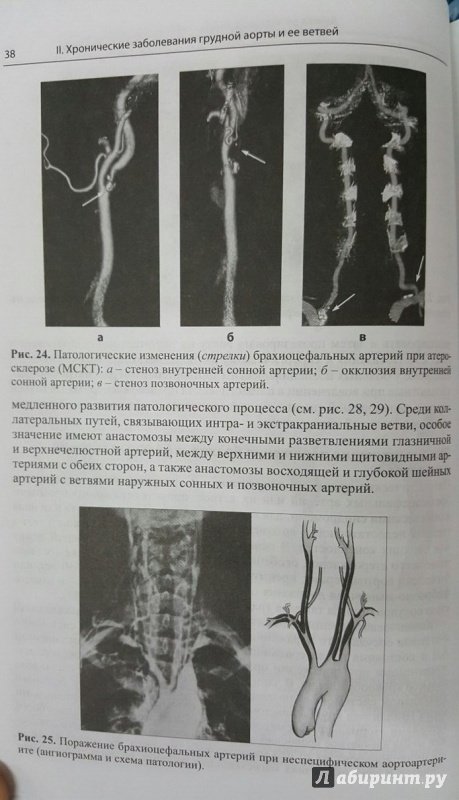 Иллюстрация 4 из 6 для Болезни артерий и вен - Евдокимов, Тополянский | Лабиринт - книги. Источник: Den