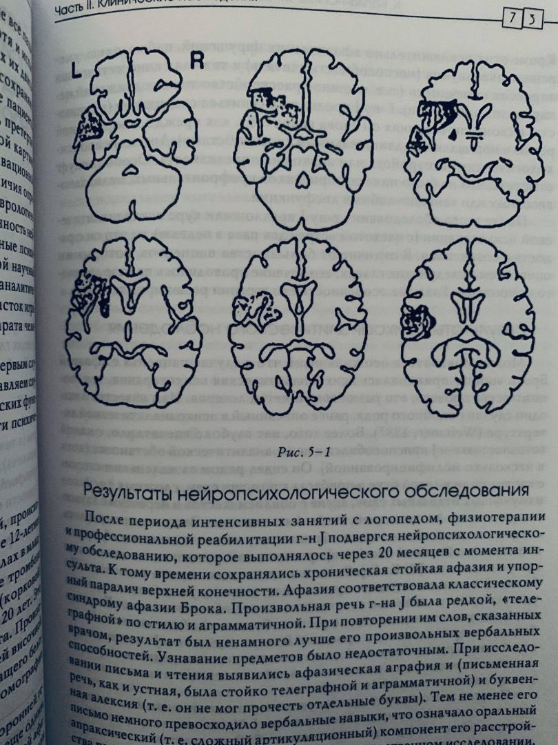 Иллюстрация 8 из 16 для Клинические исследования нейропсихоанализе. Введение в глубинную нейропсихологию - Каплан-Солмз, Солмз | Лабиринт - книги. Источник: rynako