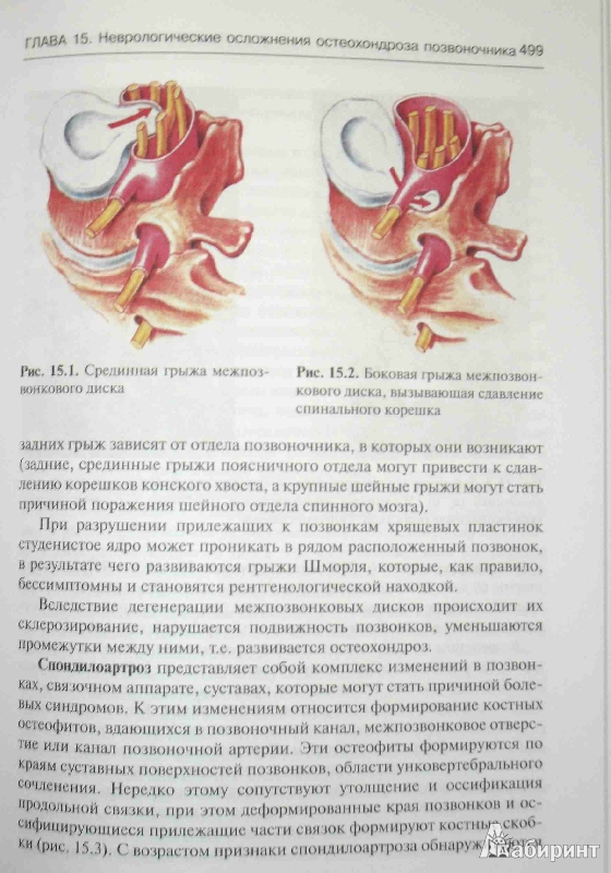 Иллюстрация 8 из 36 для Неврология и нейрохирургия. Учебник. В 2-х томах. Том 1. Неврология (+CD) - Гусев, Коновалов, Скворцова | Лабиринт - книги. Источник: ВраЧиталла