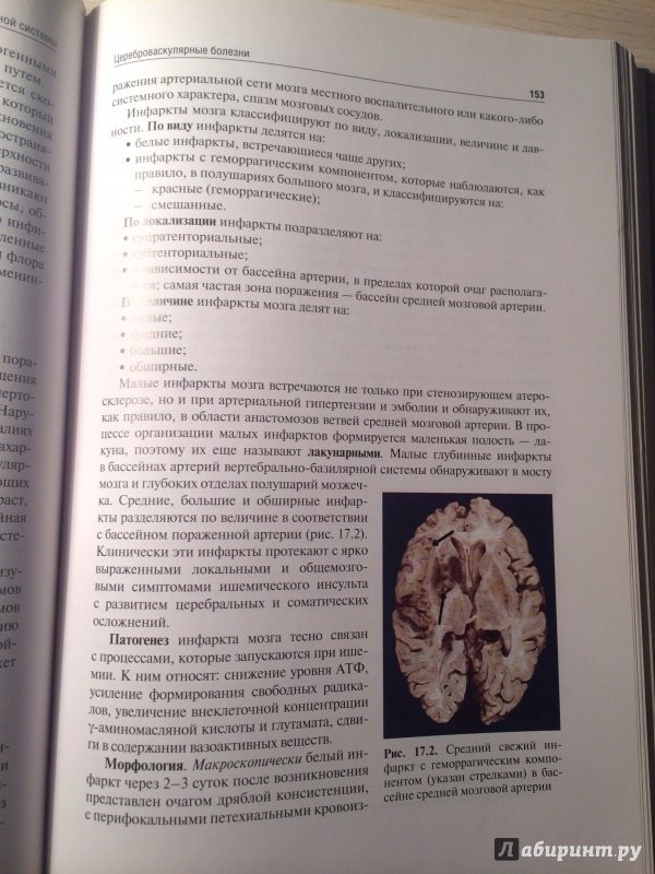 Иллюстрация 17 из 18 для Патологическая анатомия. Учебник. В 2-х томах. Том 2. Частная патология - Пауков, Пономарев, Федоров | Лабиринт - книги. Источник: | favouritevampire |