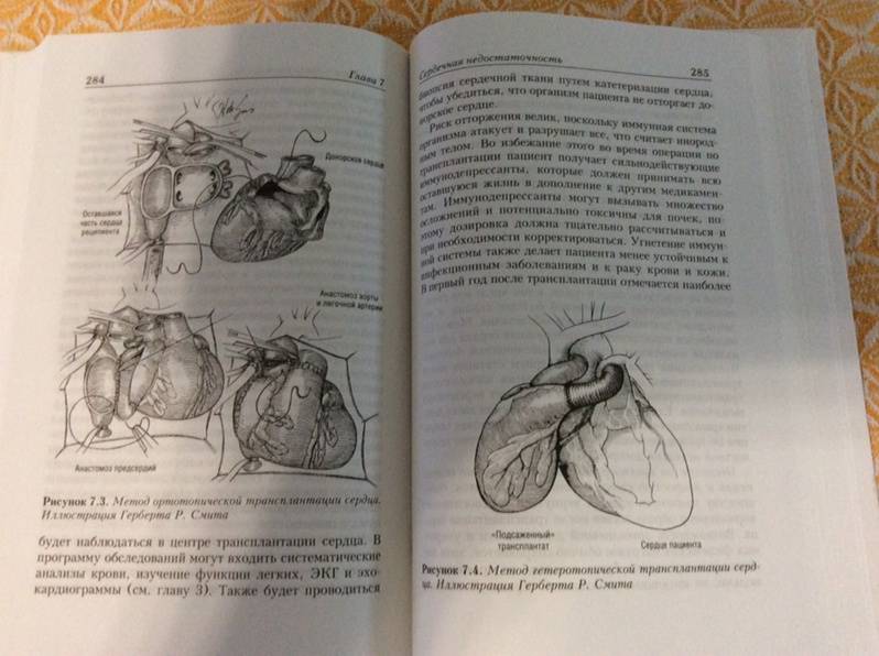 Иллюстрация 13 из 15 для Здоровое сердце. Издание XXI века - Дебейки, Готто-младший | Лабиринт - книги. Источник: L9D87