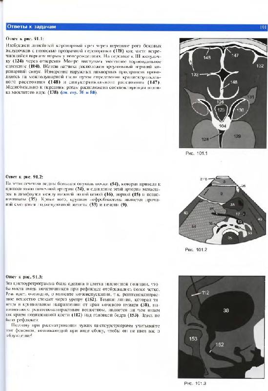 Иллюстрация 14 из 14 для Ультразвуковая диагностика. Базовый курс - Хофер, Райхс | Лабиринт - книги. Источник: Юта