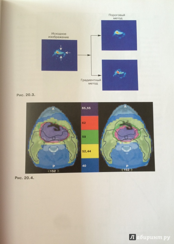 Иллюстрация 8 из 16 для Основы клинической радиобиологии - Джойнер, Ван | Лабиринт - книги. Источник: Щёлокова  Алина