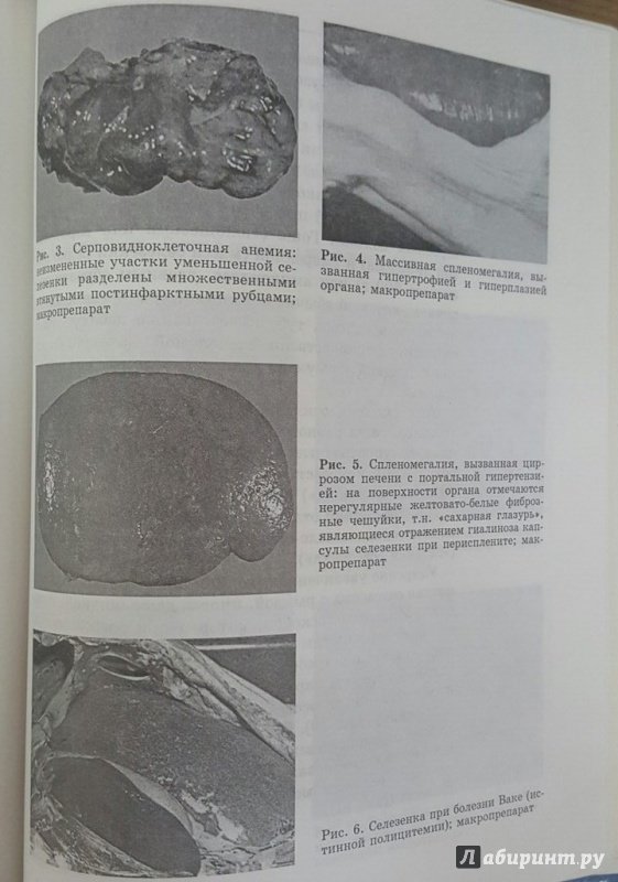 Иллюстрация 5 из 5 для Диагностика заболеваний печени, билиарного тракта, поджелудочной железы, селезенки (+CD) - Панфилова, Панфилов | Лабиринт - книги. Источник: Den