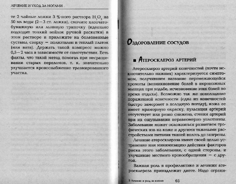 Иллюстрация 8 из 14 для Лечение и уход за ногами - Вера Соловьева | Лабиринт - книги. Источник: Росинка