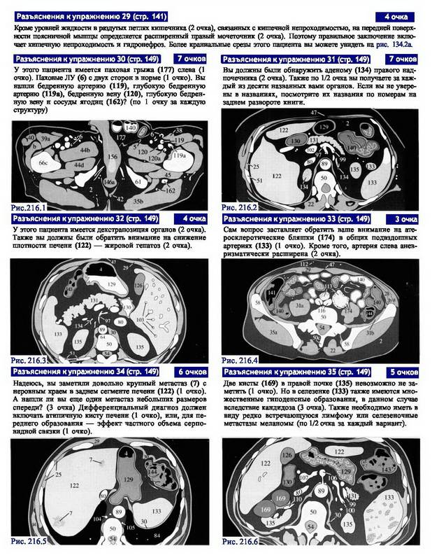 Иллюстрация 14 из 14 для Компьютерная томография. Базовое руководство - Матиас Хофер | Лабиринт - книги. Источник: Риззи