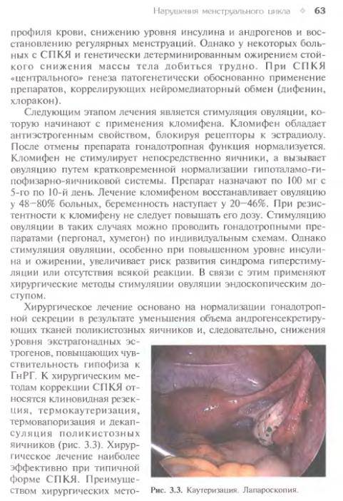 Иллюстрация 17 из 26 для Гинекология | Лабиринт - книги. Источник: Федосов  Прохор Сергеевич