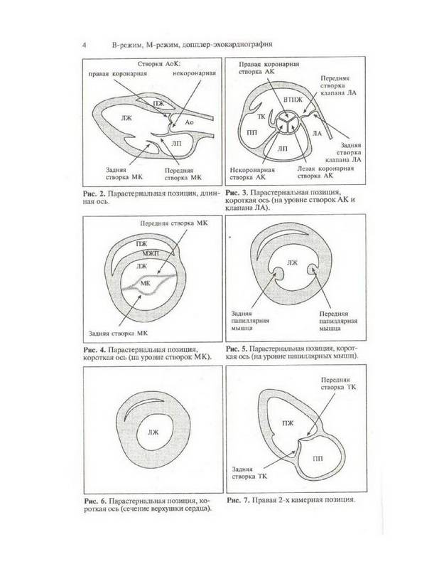 Иллюстрация 3 из 7 для Справочник по эхокардиографии - Вилкенсхоф, Крук | Лабиринт - книги. Источник: Ялина