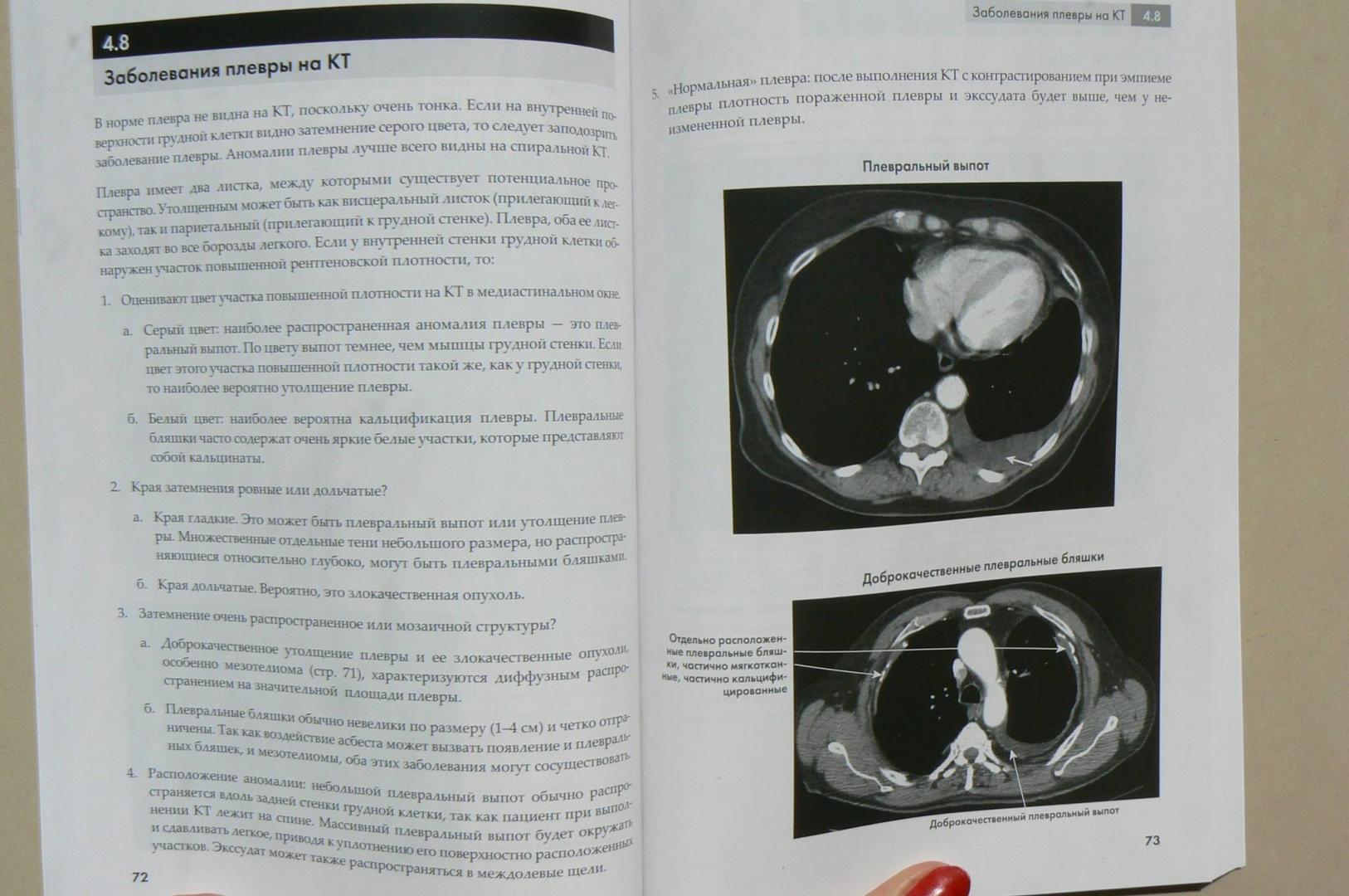Иллюстрация 11 из 11 для Рентгенография грудной клетки - Корн, Пойнтон | Лабиринт - книги. Источник: Лидия