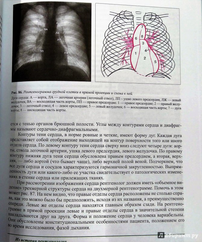 Иллюстрация 49 из 53 для Лучевая диагностика. Учебник - Королюк, Линденбратен | Лабиринт - книги. Источник: Савчук Ирина
