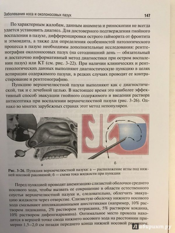Иллюстрация 27 из 42 для Оториноларингология. Учебник - Пальчун, Лучихин, Магомедов | Лабиринт - книги. Источник: Ромыдтчъ