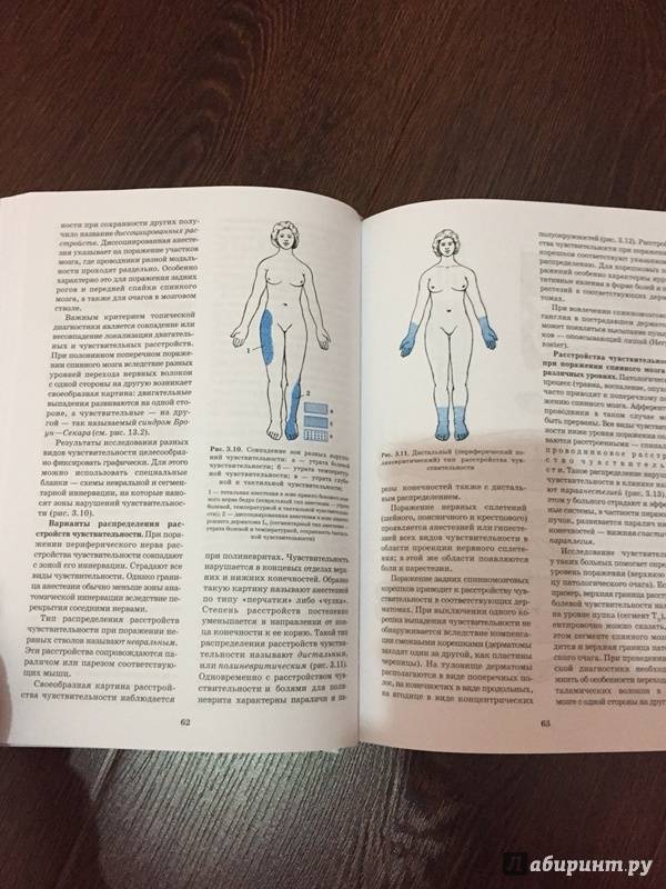 Иллюстрация 39 из 49 для Топическая диагностика заболеваний нервной системы. Руководство для врачей - Скоромец, Скоромец, Скоромец | Лабиринт - книги. Источник: Дилан