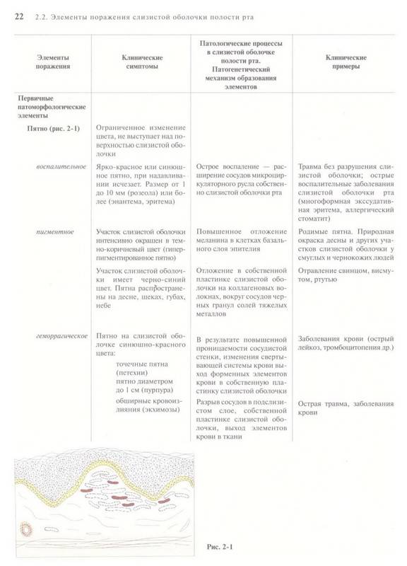 Иллюстрация 9 из 28 для Терапевтическая стоматология. Заболевания слизистой оболочки рта. В 3-х частях. Часть 3. Учебник - Барер, Волков, Гемонов | Лабиринт - книги. Источник: Ялина