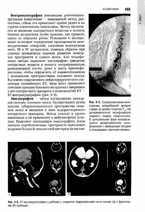 Иллюстрация 44 из 55 для Неврология: национальное руководство (+CD) | Лабиринт - книги. Источник: Федосов  Прохор Сергеевич