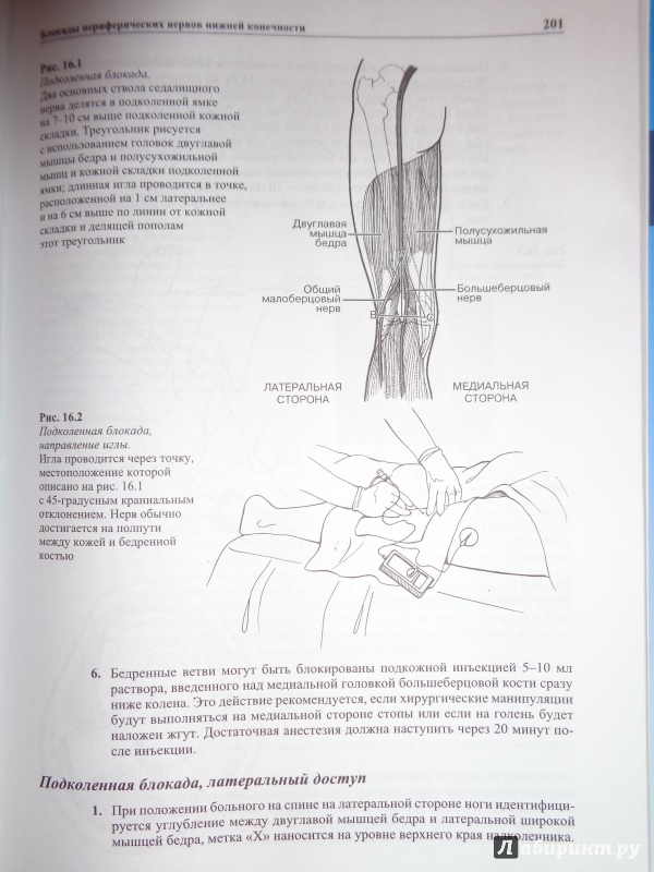 Иллюстрация 7 из 14 для Местная анестезия. Практическое руководство - Малрой, Бернардс, Макдональд, Салинас | Лабиринт - книги. Источник: Лабиринт