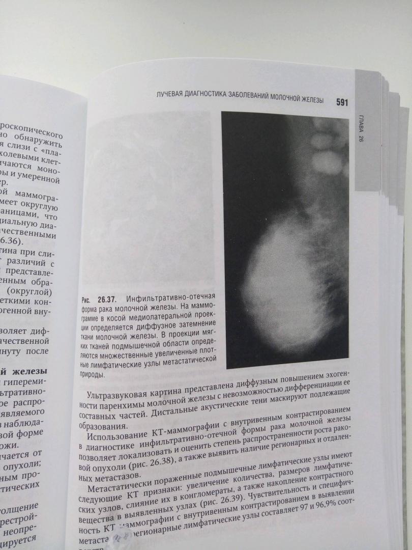 Иллюстрация 28 из 29 для Лучевая диагностика и терапия в акушерстве и гинекологии - Адамян, Гус, Демидов, Обельчак | Лабиринт - книги. Источник: Лабиринт