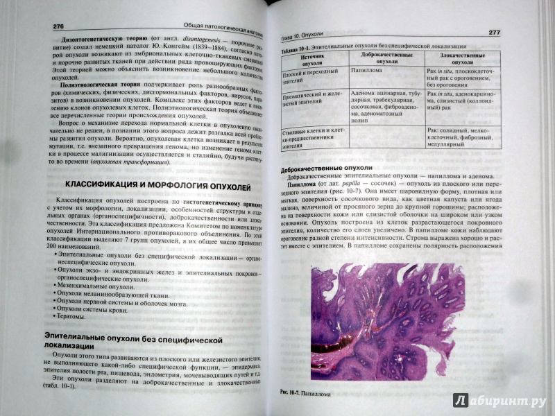 Иллюстрация 8 из 37 для Патологическая анатомия. Учебник - Струков, Серов | Лабиринт - книги. Источник: Лабиринт