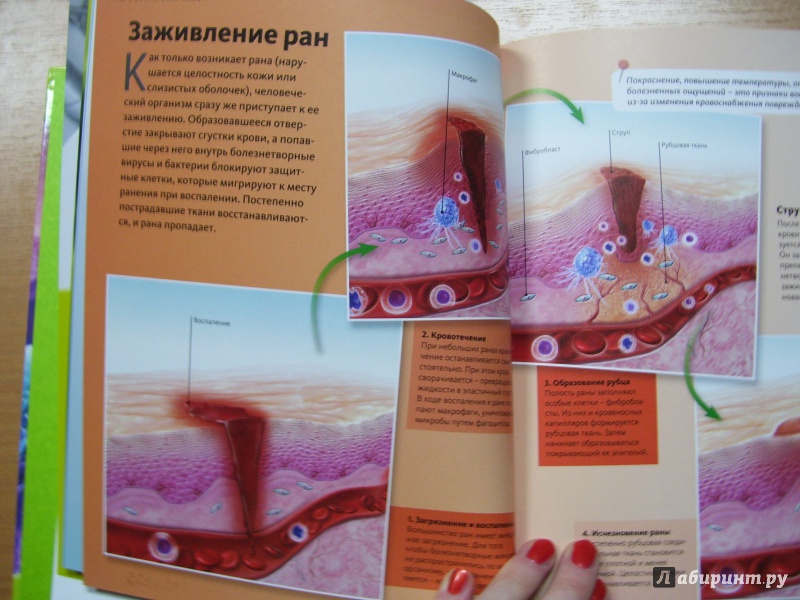Иллюстрация 15 из 18 для Война микробов | Лабиринт - книги. Источник: КошкаПолосатая