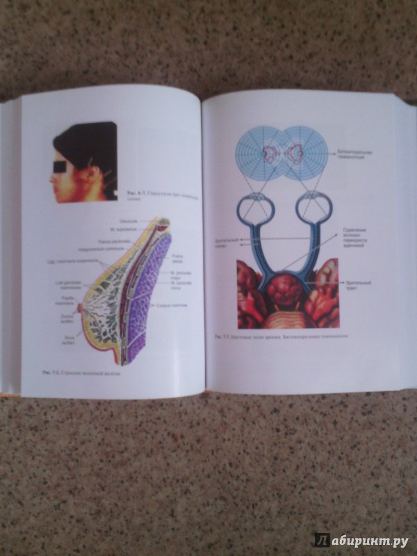 Иллюстрация 13 из 15 для Симптом, синдром, диагноз. Дифференциальная диагностика в гинекологии - Подзолкова, Глазкова | Лабиринт - книги. Источник: Лабиринт