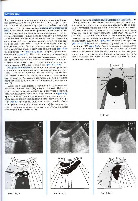 Иллюстрация 8 из 14 для Ультразвуковая диагностика. Базовый курс - Хофер, Райхс | Лабиринт - книги. Источник: Юта