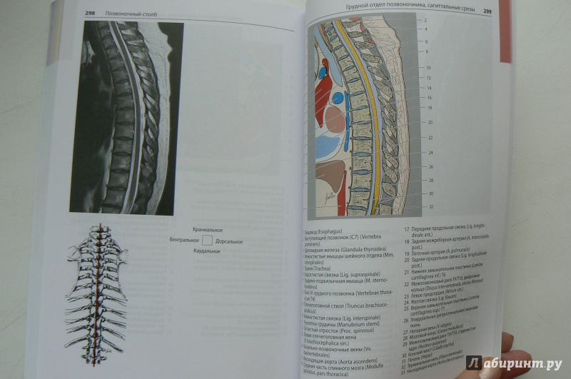 Иллюстрация 6 из 12 для Атлас секционной анатомии человека на примере КТ- и МРТ-срезов. Том 3. Позвоночник, конечности - Меллер, Райф | Лабиринт - книги. Источник: Марина