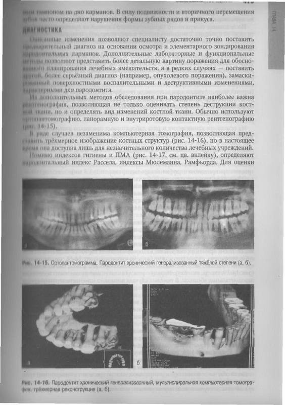 Иллюстрация 37 из 55 для Терапевтическая стоматология: национальное руководство (+CD) | Лабиринт - книги. Источник: Ялина
