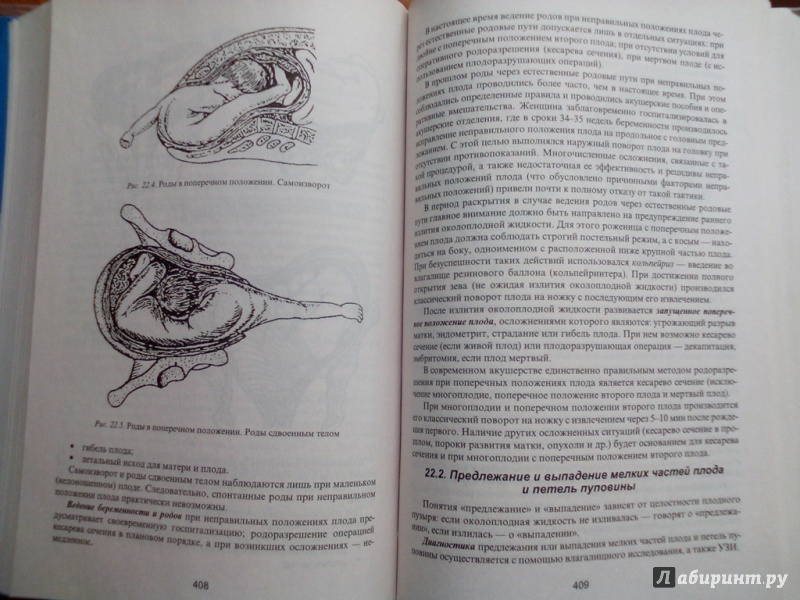 Иллюстрация 24 из 32 для Акушерство - Виталий Дуда | Лабиринт - книги. Источник: Кувшинова  Таня Константиновна
