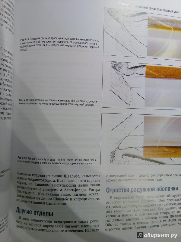 Иллюстрация 4 из 13 для Атлас по гониоскопии (+CD) - Олвэрд, Лонгмуа | Лабиринт - книги. Источник: Моисеев  Роман