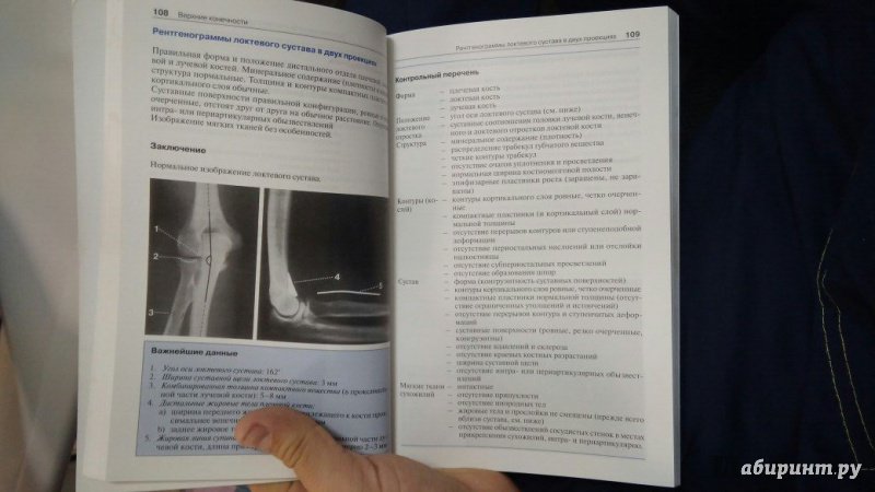 Иллюстрация 29 из 30 для Норма при рентгенологических исследованиях - Торстен Меллер | Лабиринт - книги. Источник: Лабиринт