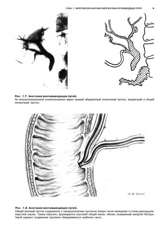 Иллюстрация 23 из 44 для Атлас абдоминальной хирургии. Том 1. Хирургия печени, желчных путей, поджелудочной железы - Эмилио Итала | Лабиринт - книги. Источник: Риззи