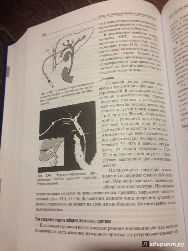 Иллюстрация 6 из 62 для Хирургические болезни. Учебник - Ветшев, Кузин, Касян | Лабиринт - книги. Источник: ВраЧиталла